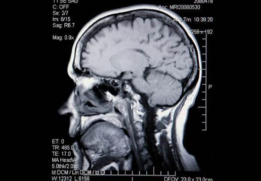 人体自救的九个惊人秘密